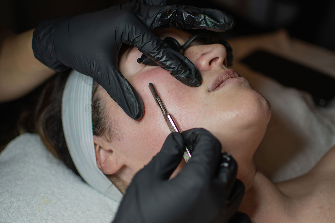 Dermaplaning Willow Primary Care